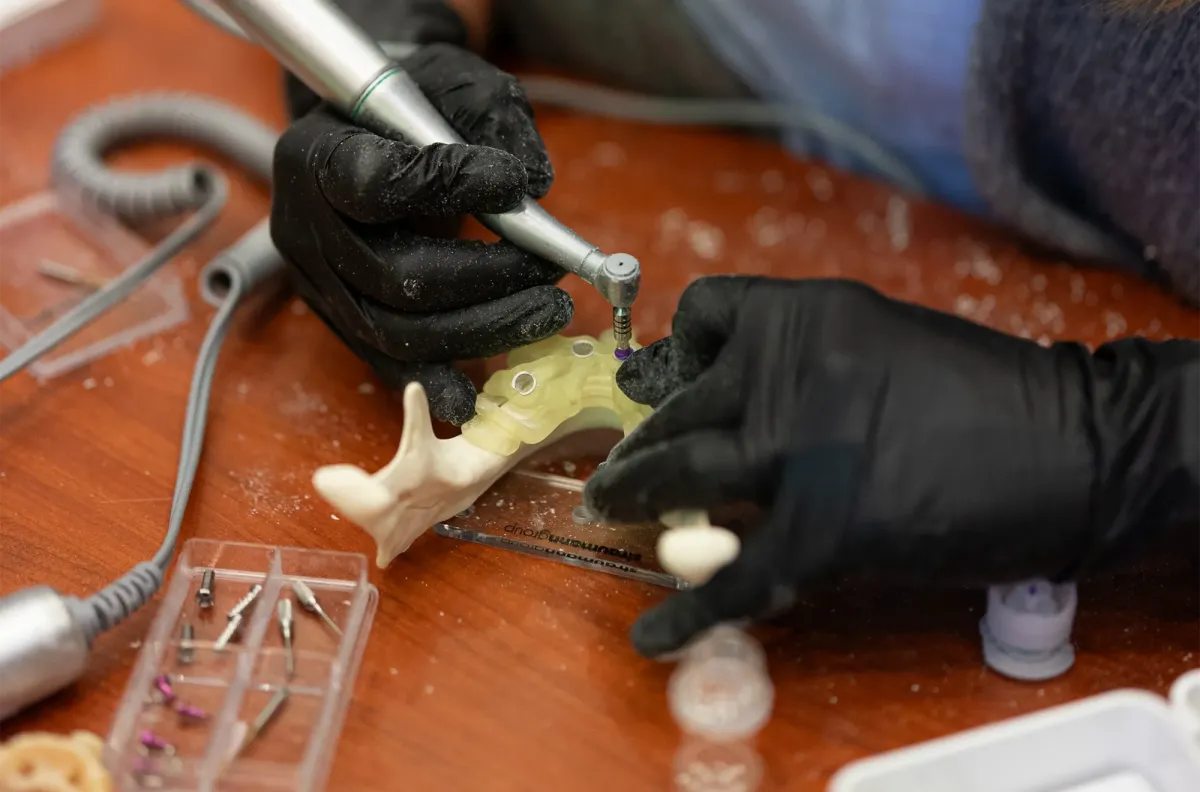 Full-Arch Implants ractice