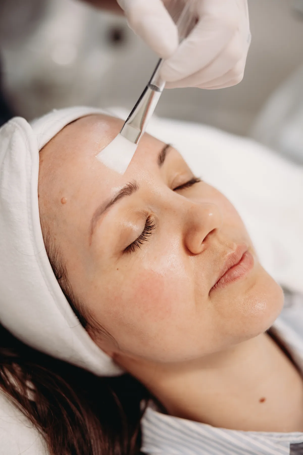Clinicare AHA and EGF Skin Booster being applied to a client during a professional skin treatment at Prestige Skin clinic near Cambridge