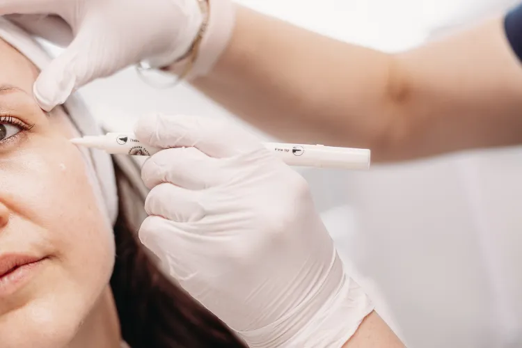 Mrking p the ace for ceek fillr at Prestige Skin Camridge