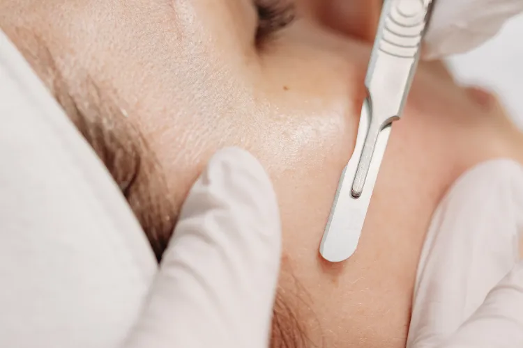 Close-up of a Botox® injection about to be administered to the forehead at Prestige Skin Cambridge