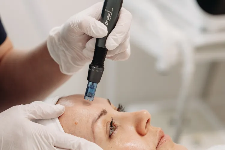 Close-up of a Botox® injection about to be administered to the forehead at Prestige Skin Cambridge