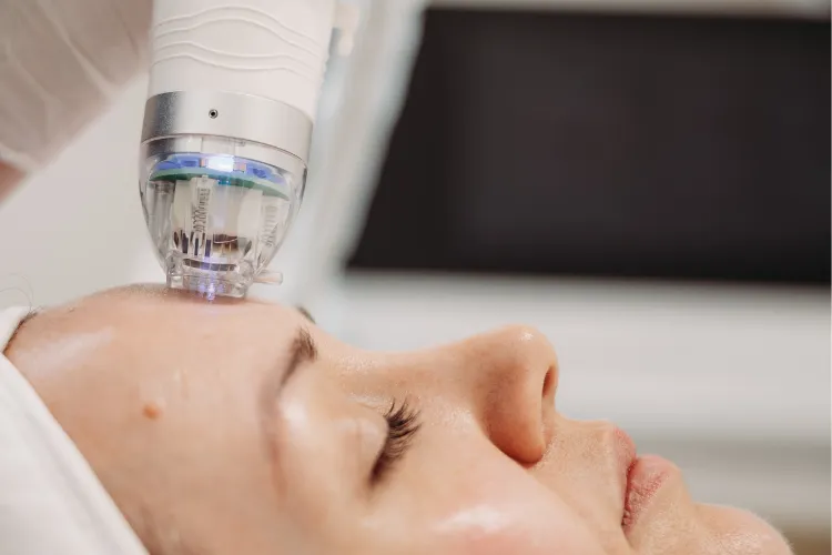 Close-up of a Botox® injection about to be administered to the forehead at Prestige Skin Cambridge