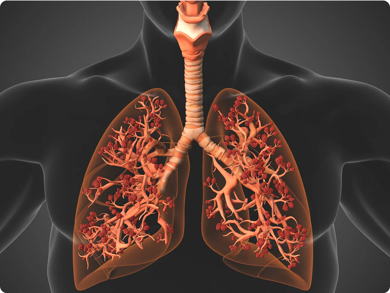 RespiClear lung support
