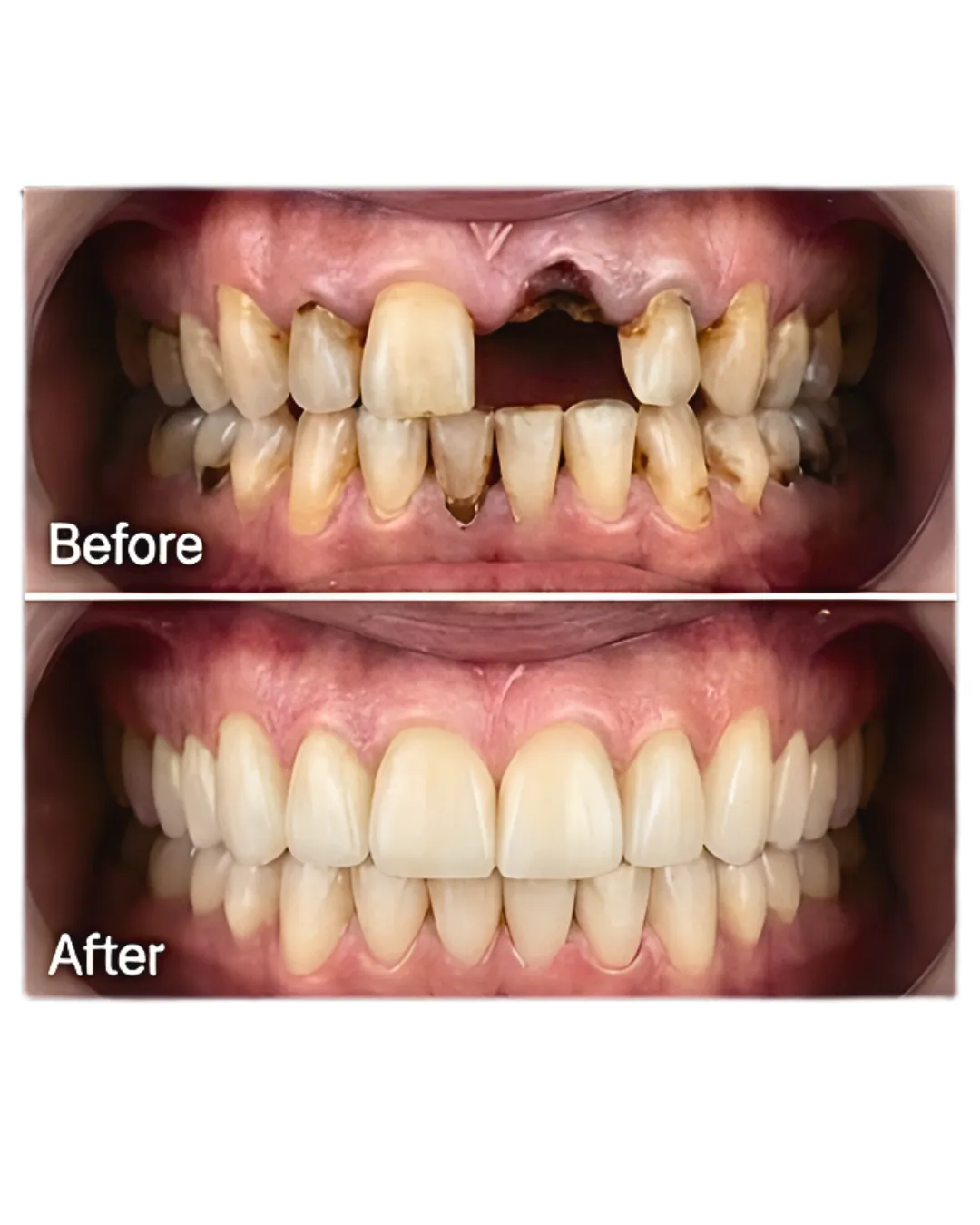 white ceramic sink near white ceramic sink