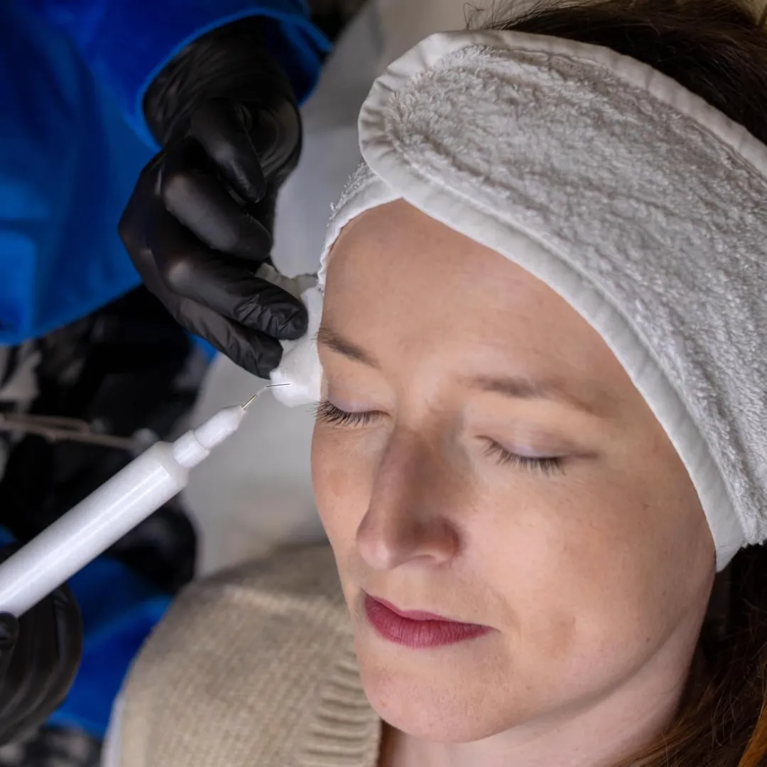 Soin visage anti-âge utilisant la technique plasma lift à Cherbourg