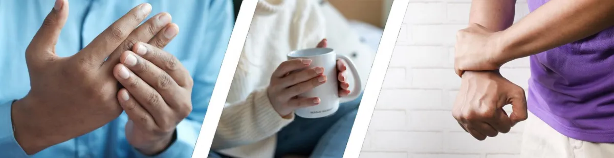 Stem cell therapy offers a new path for arthritis relief — targeting joint degeneration, reducing inflammation, and supporting long-term mobility and comfort.