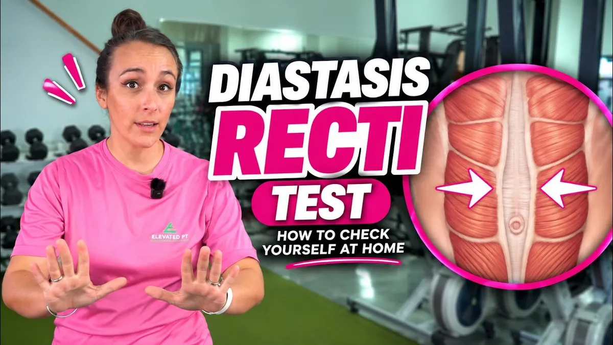 postpartum, diastisis recti, home test 