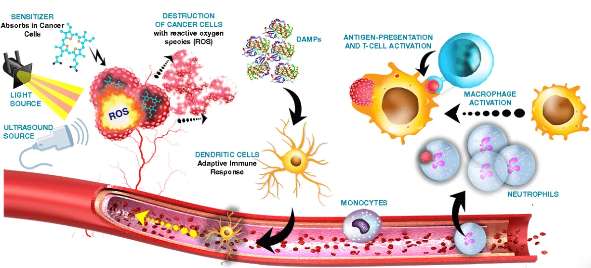 Sono-Photo Dynamic Therapy