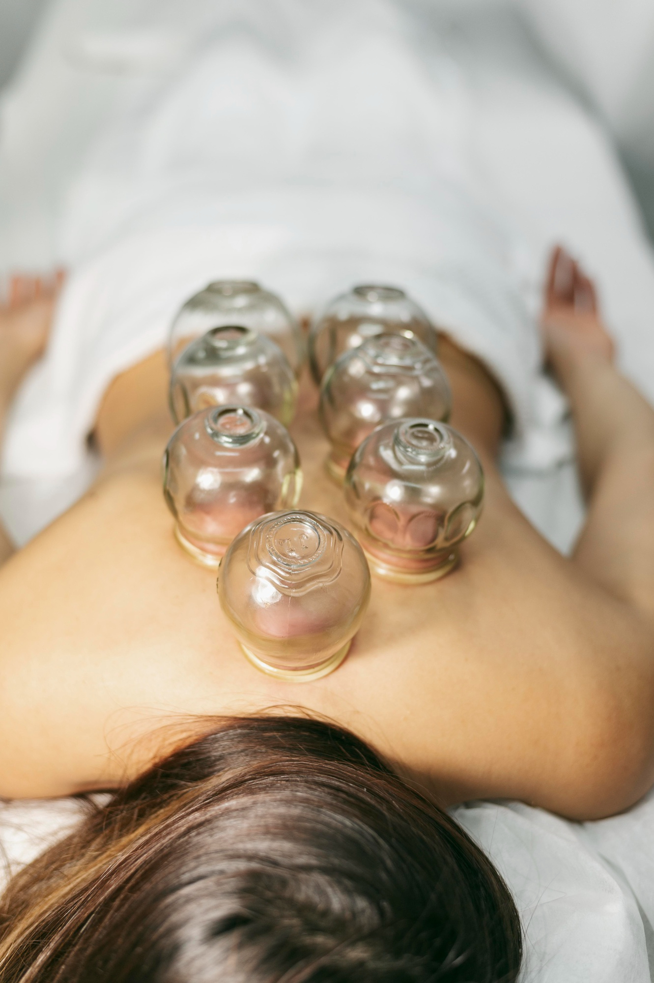 Cupping Therapy in Huntsville, Alabama
