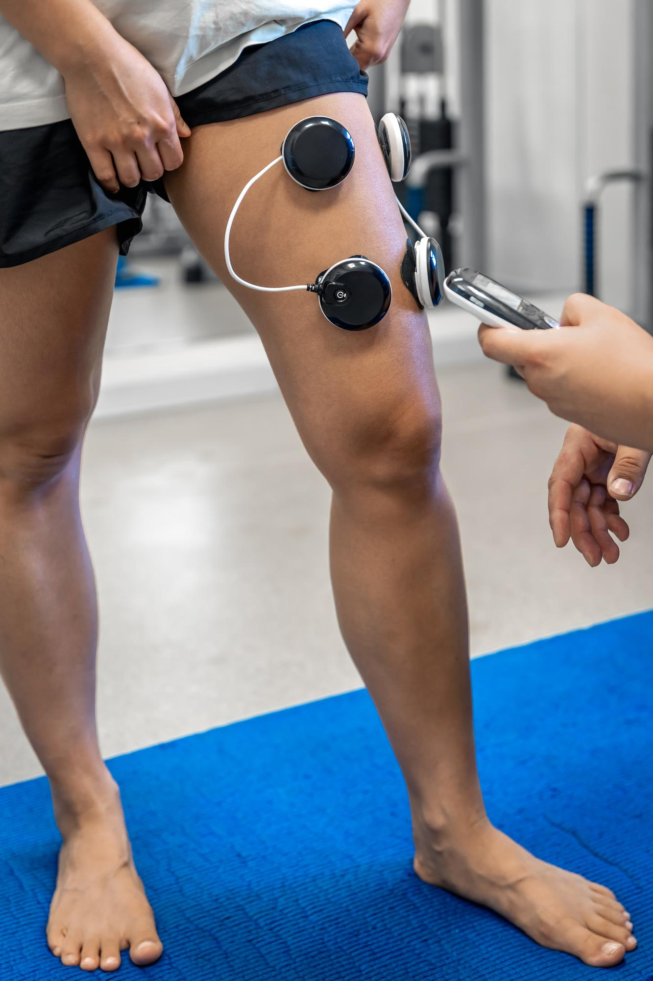 Electrical Stimulation in Madison Alabama