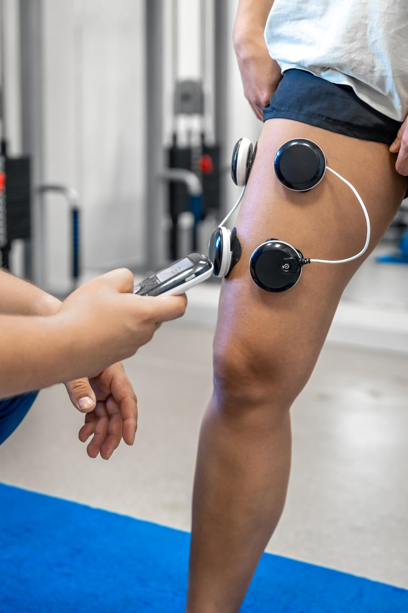 Electrical Stimulation in Huntsville, Alabama