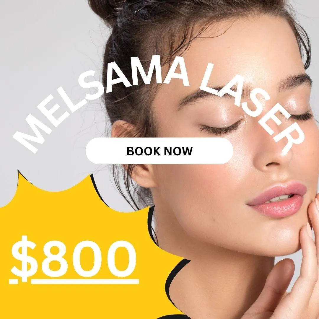 Melasma Laser