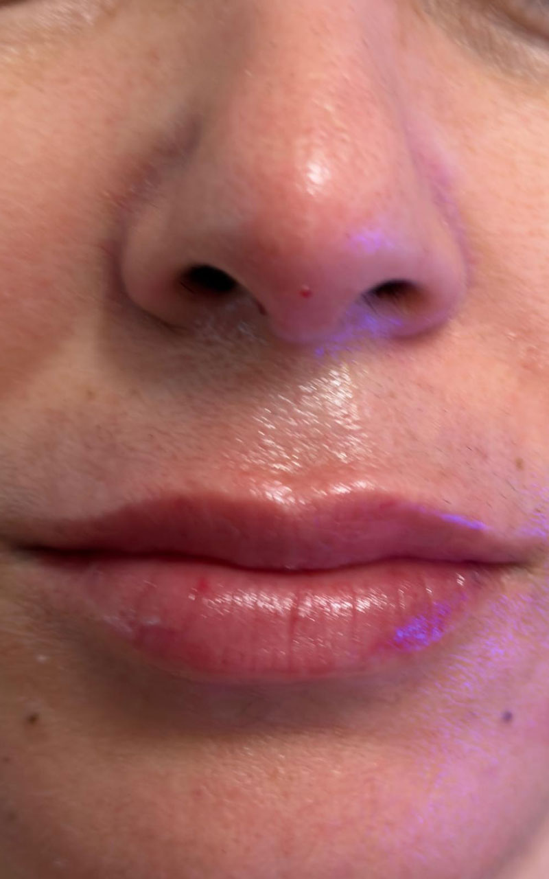 Lips hydration at Lilis Skin Care