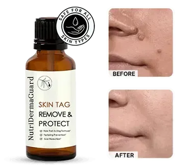Nutri Derma Guard-buy