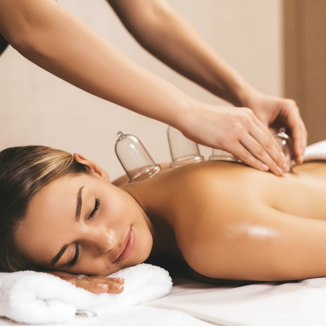 Cupping therapy in Werribee using gentle suction cups to improve circulation, ease tension, and support recovery.
