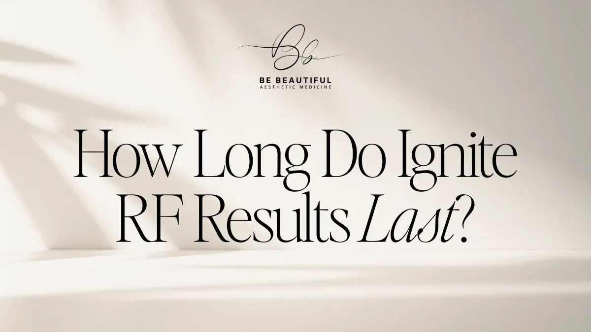 How Long Do Ignite RF Results Last?
