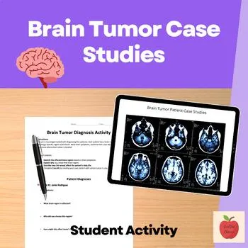 Preview of Psychology activity: brain tumor neurology case study