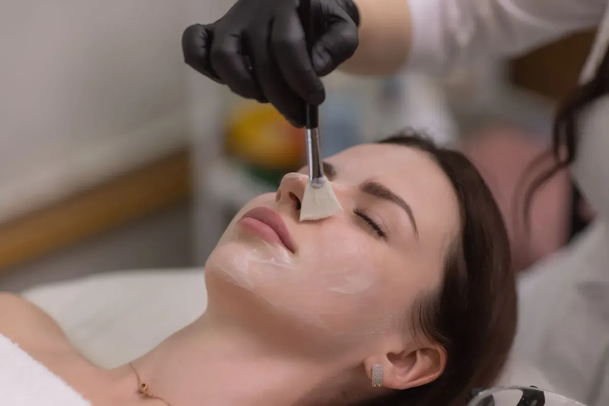 Unlock the Secrets of Radiant Skin with Chemical Peels
