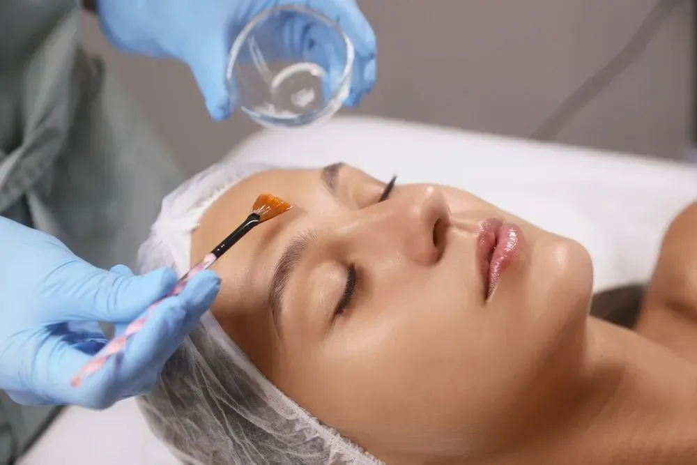 Revitalize Your Skin: The Ultimate Guide to Chemical Peels