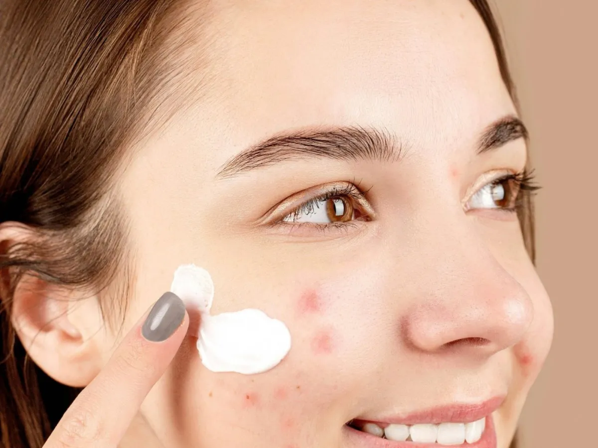 Acne & Pigmentation treatments