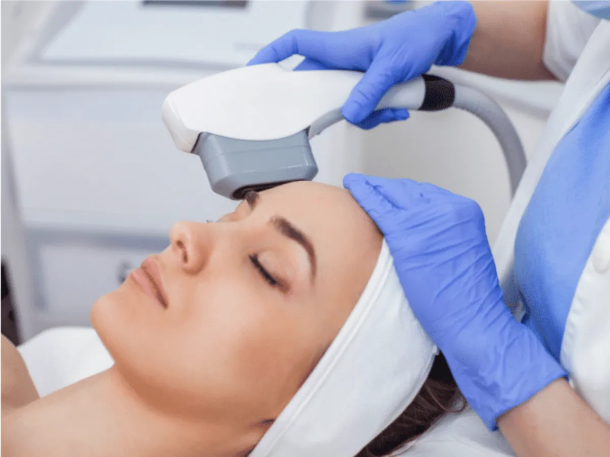 IPL Skin Rejuvenation