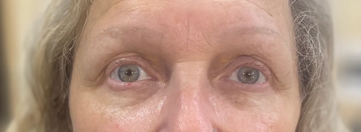 After tantric tattoo permanent makeup treatment showing defined brows and enhanced eyeliner results.