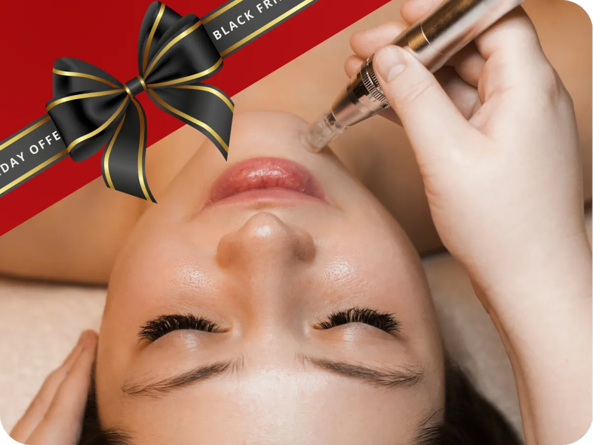 MICRONEEDLING_SKIN_HEALTH_BRISTOL