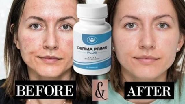 Derma Prime Results