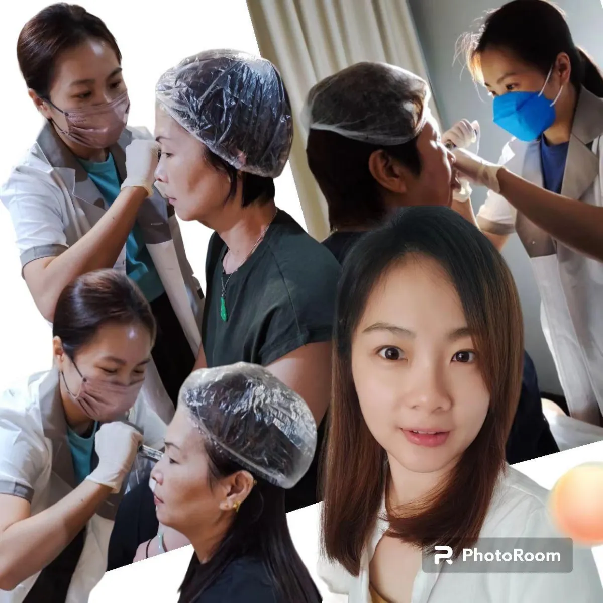 鱼尾纹 抬头纹 法令纹 眼下细纹 木偶纹 脸部凹陷 太阳穴凹陷