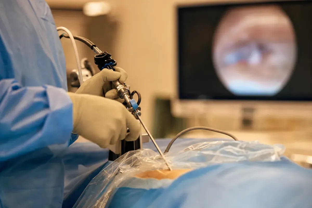Surgeon operating a slim spinal endoscope with an HD monitor view in a warm operating room