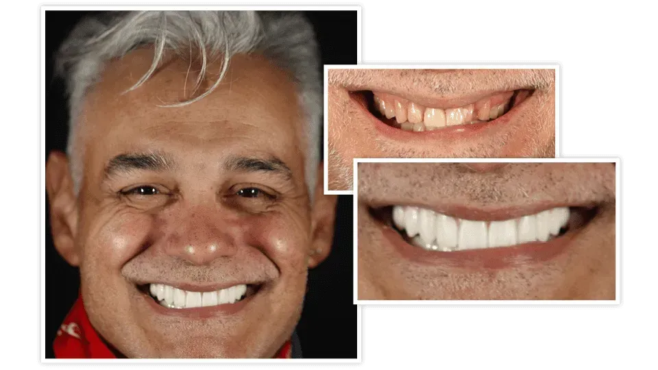 Couple Smiling with Perfect Teeth