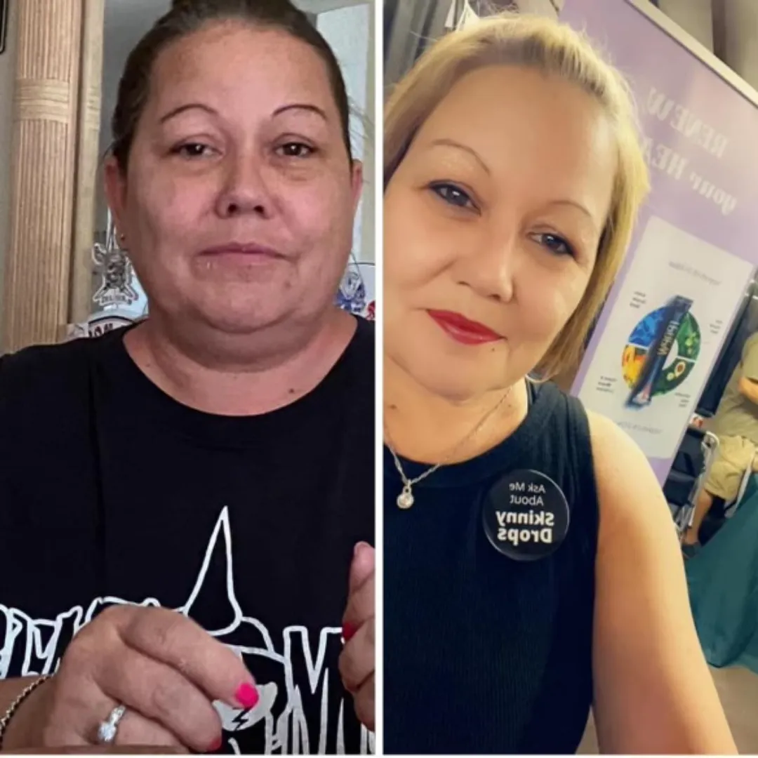 Before and After My Healthy Reach woman