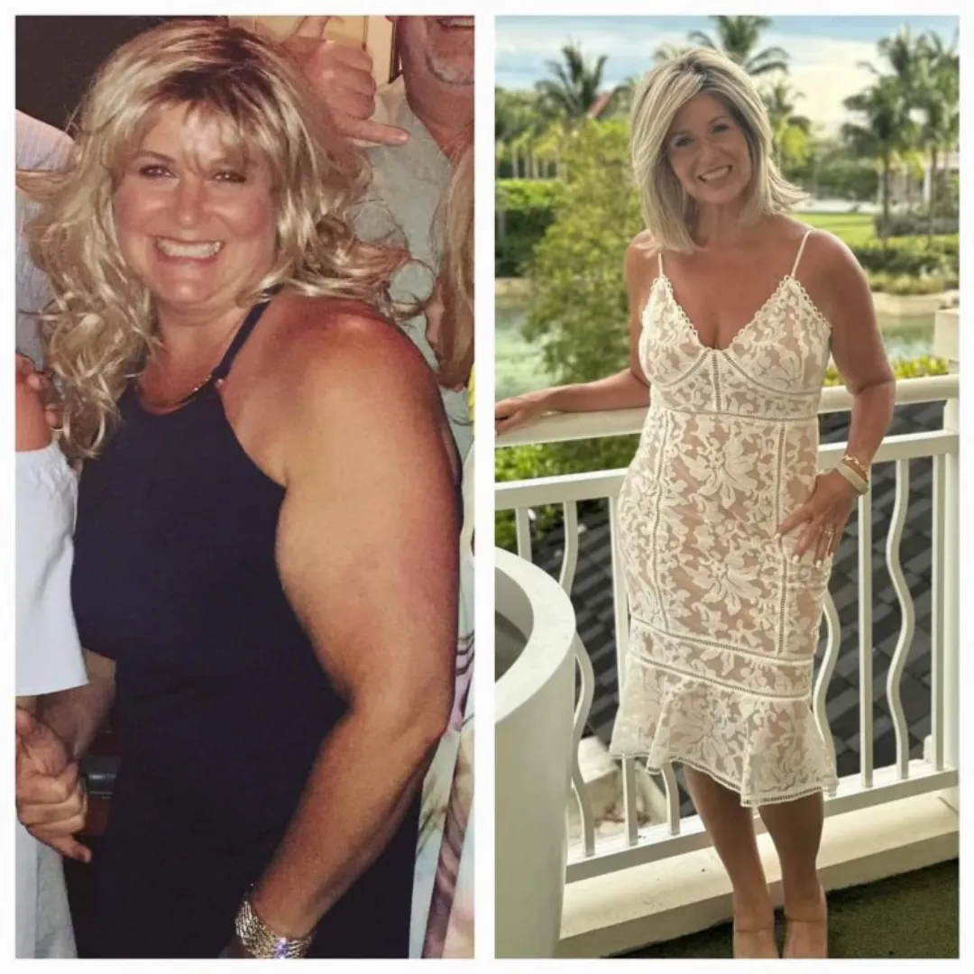 Before and After My Healthy Reach dr kristi