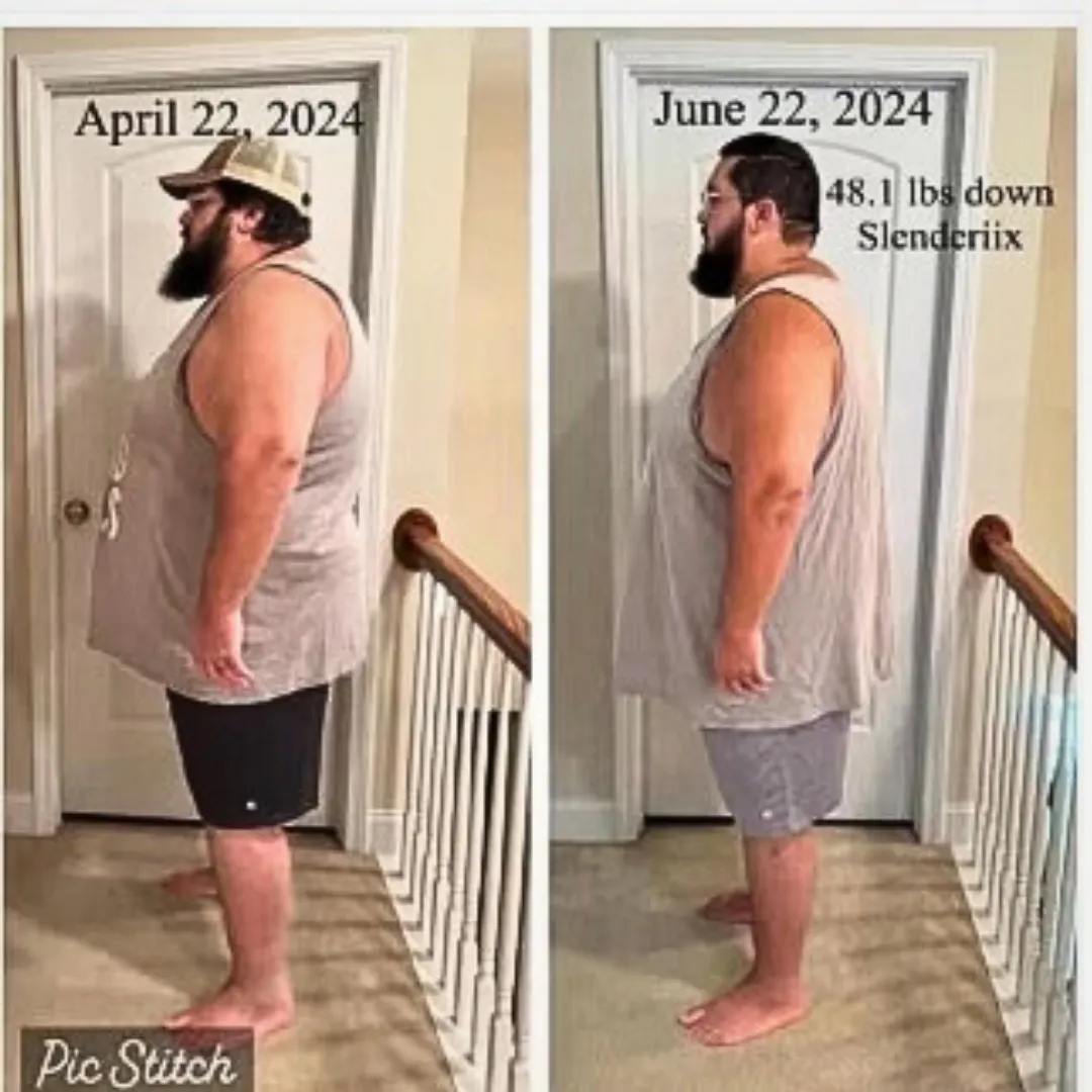 Before and After My Healthy Reach guy 48 lbs weight loss