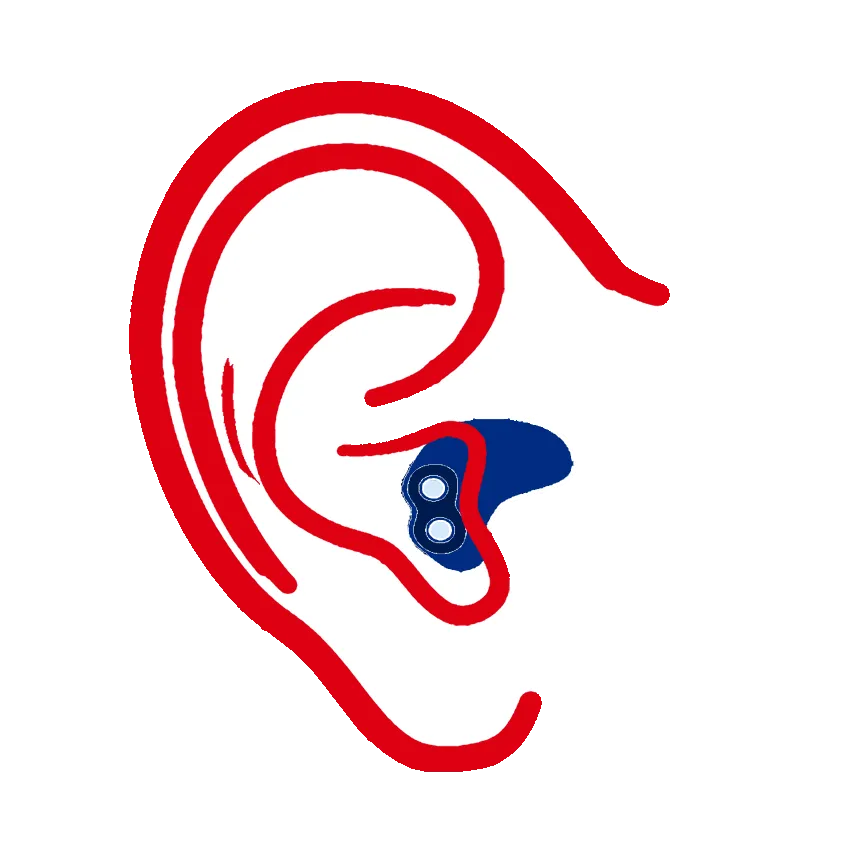 Hearing aids Sydney Northern Beaches