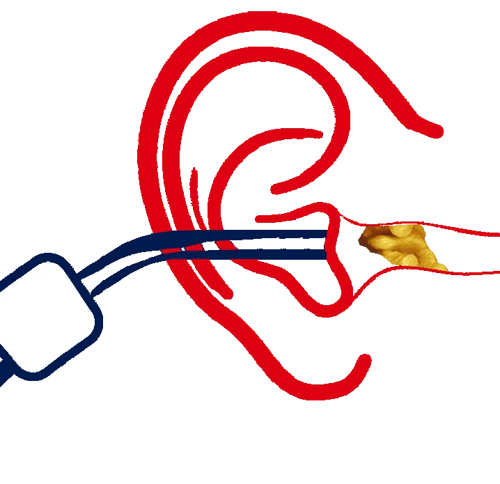 Earwax removal Melbourne