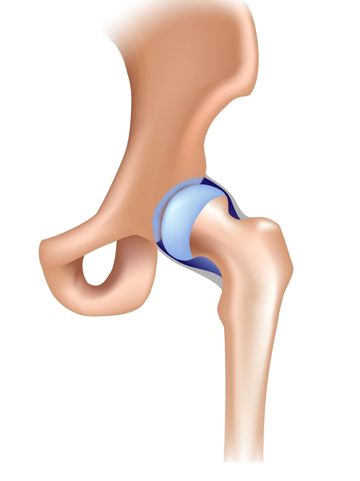 3D medical illustration of a human hip joint against a plain background, highlighting the cartilage and bone structure