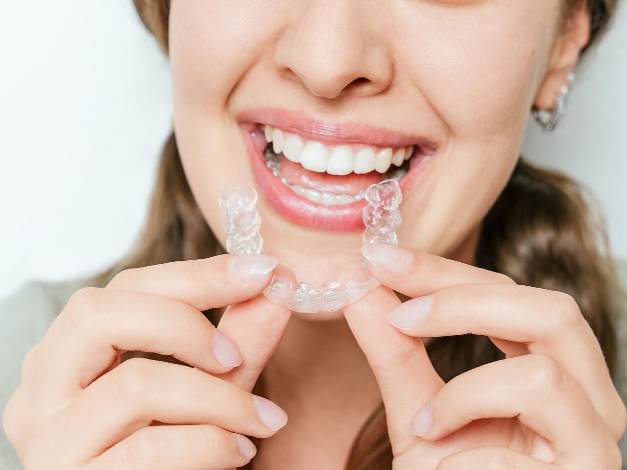 person wearing Invisalign clear aligners