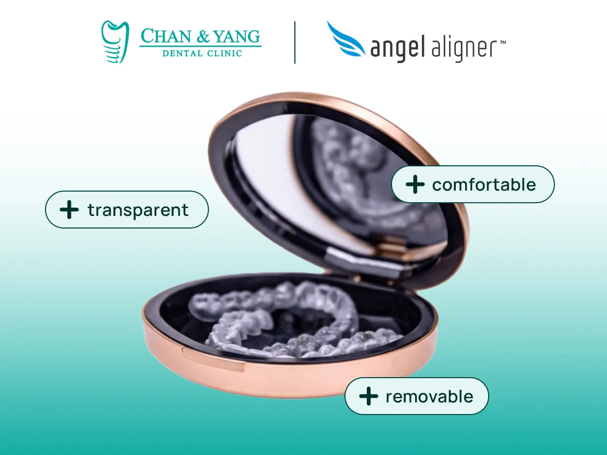 benefits of Invisalign clear aligners with Chan & Yang Dental Clinic