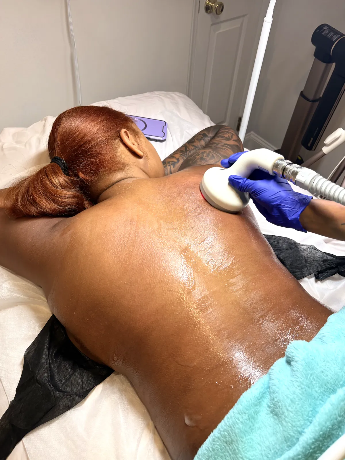 Licensed provider performing a T-Shape body sculpting treatment on a client's back at NuVée Aesthetics in Durham