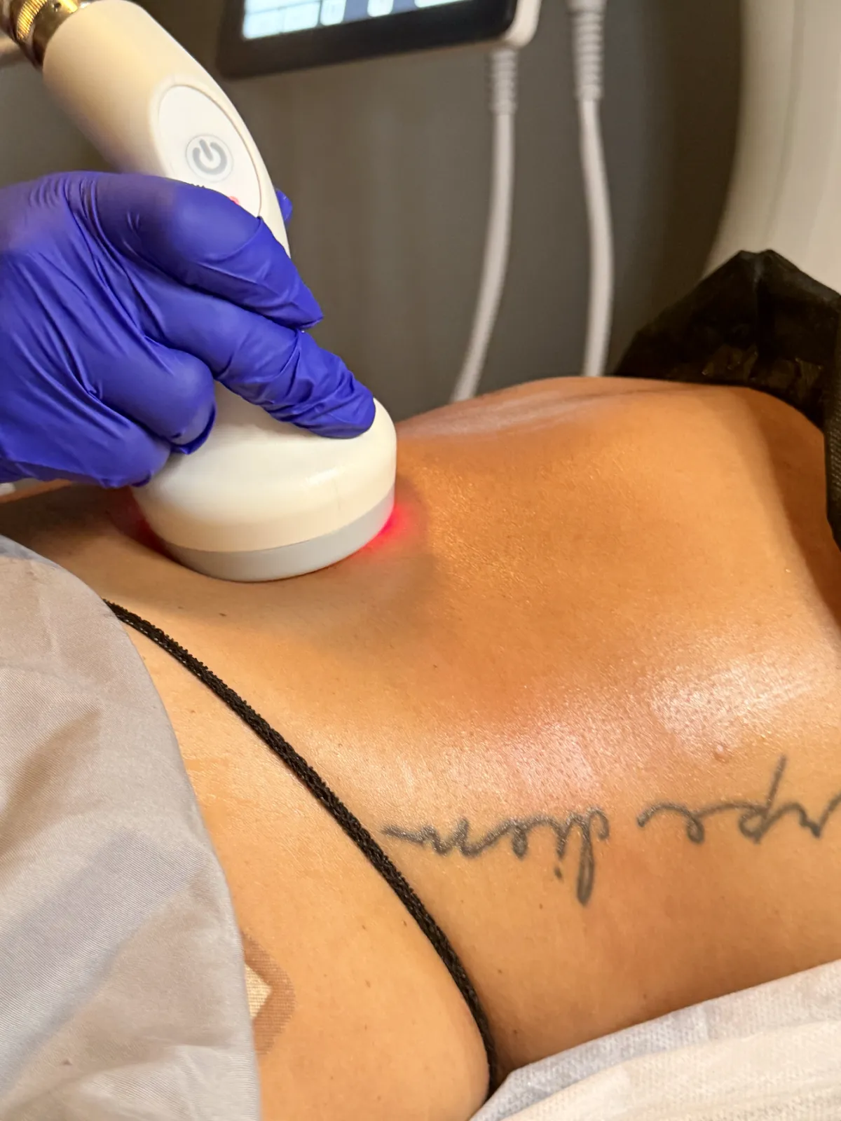 Licensed provider performing a T-Shape body sculpting treatment on a client's stomach at NuVée Aesthetics in Durham