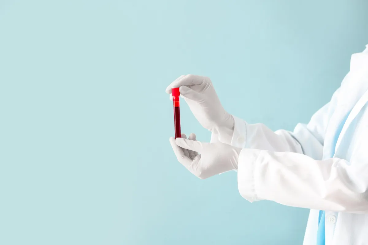Why a Blood Panel Is a Game-Changer for Your Weight Loss Transformation — Empire Gym Effingham