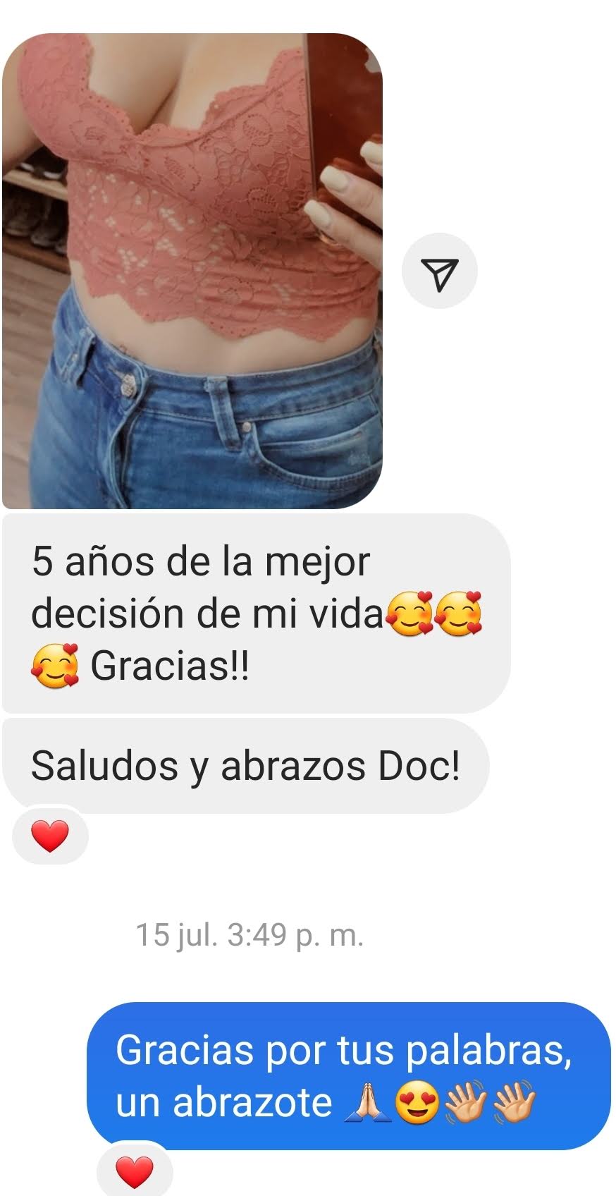 Resultados antes y después de ginecomastia