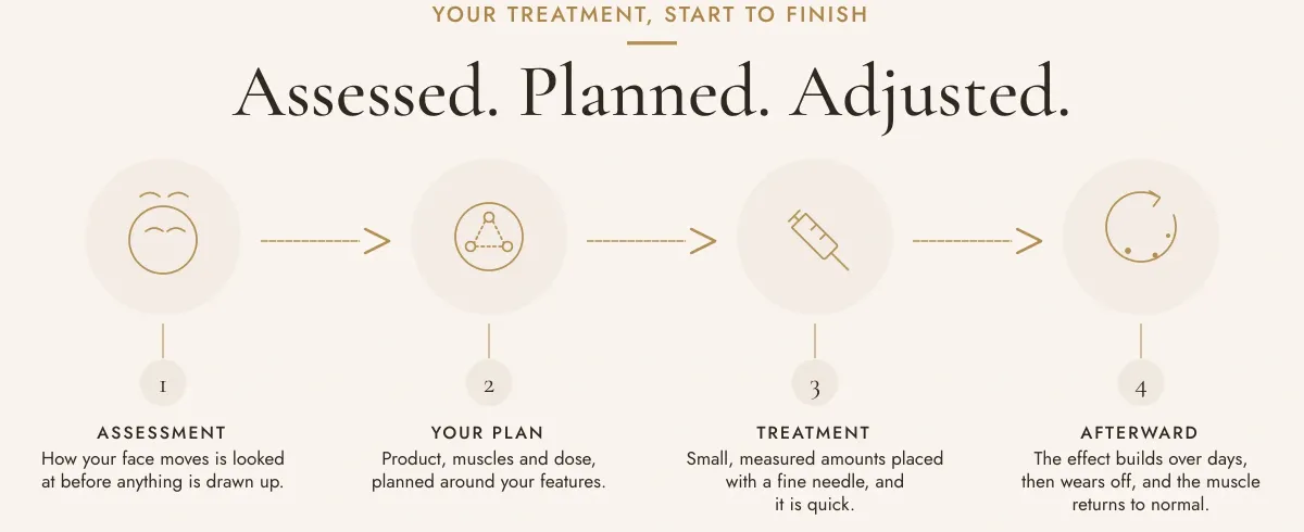 Your treatment, start to finish. Assessed. Planned. Adjusted. One, assessment: how your face moves is looked at before anything is drawn up. Two, your plan: product, muscles and dose, planned around your features. Three, treatment: small, measured amounts placed with a fine needle, and it is quick. Four, afterward: the effect builds over days, then wears off, and the muscle returns to normal.