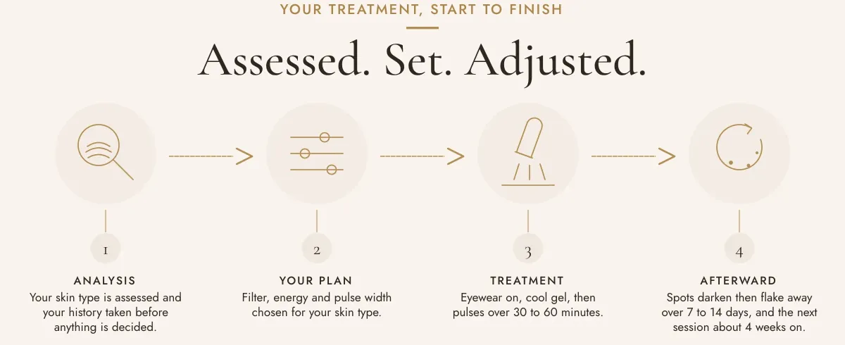 Your treatment, start to finish. Assessed. Set. Adjusted. One, analysis: your skin type is assessed and your history taken before anything is decided. Two, your plan: filter, energy and pulse width chosen for your skin type. Three, treatment: eyewear on, cool gel, then pulses over 30 to 60 minutes. Four, afterward: spots darken then flake away over 7 to 14 days, and the next session about 4 weeks on.