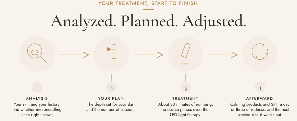 Your treatment, start to finish. Analyzed. Planned. Adjusted. One, analysis: your skin and your history, and whether microneedling is the right answer. Two, your plan: the depth set for your skin, and the number of sessions. Three, treatment: about 30 minutes of numbing, then the device passes over. Four, afterward: calming products and SPF, a day or three of redness, and the next session 4 to 6 weeks out.