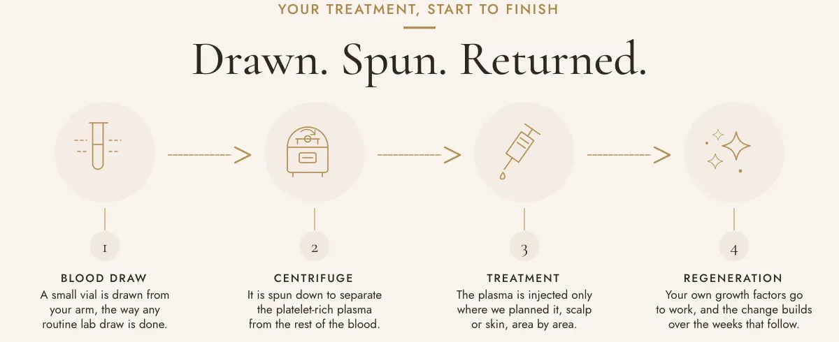 Four-step graphic of the PRP treatment process: scalp assessment, treatment plan, PRP injection, and aftercare, from consultation through a roughly one-hour appointment.