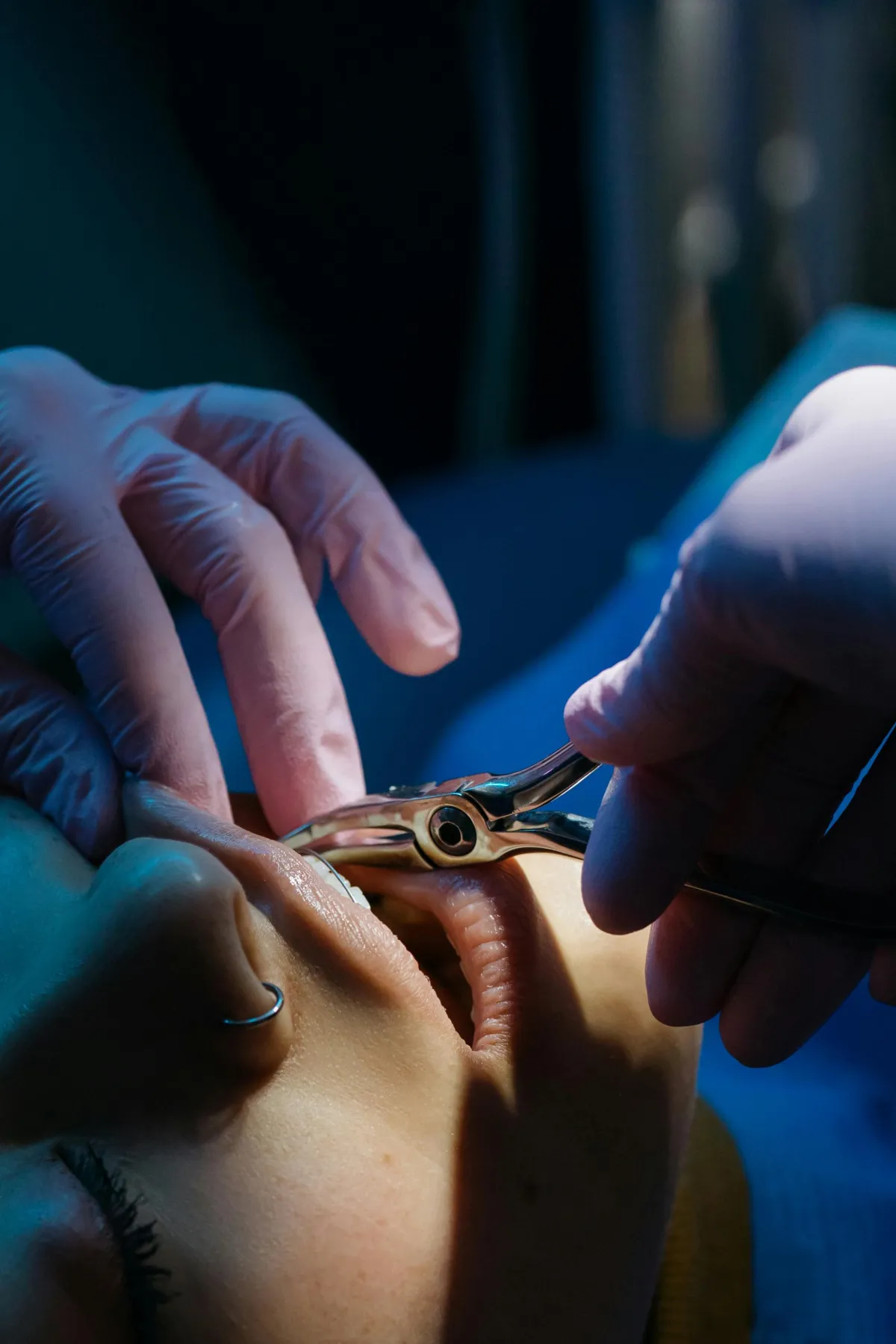 Woman sitting for tooth extraction