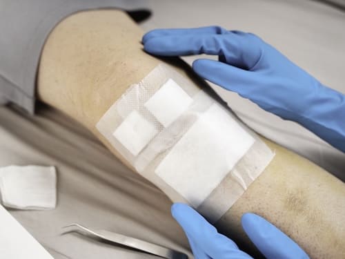 Wound Care in Drayton Valley