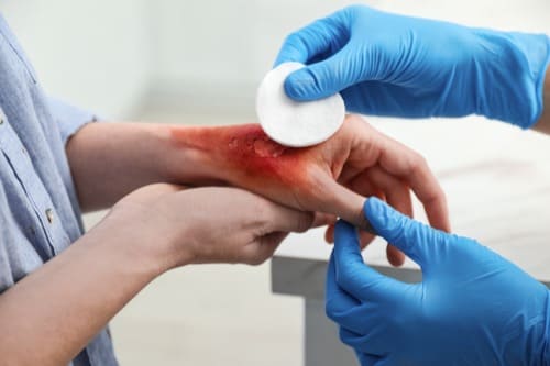 Rocky Rapids Wound Care